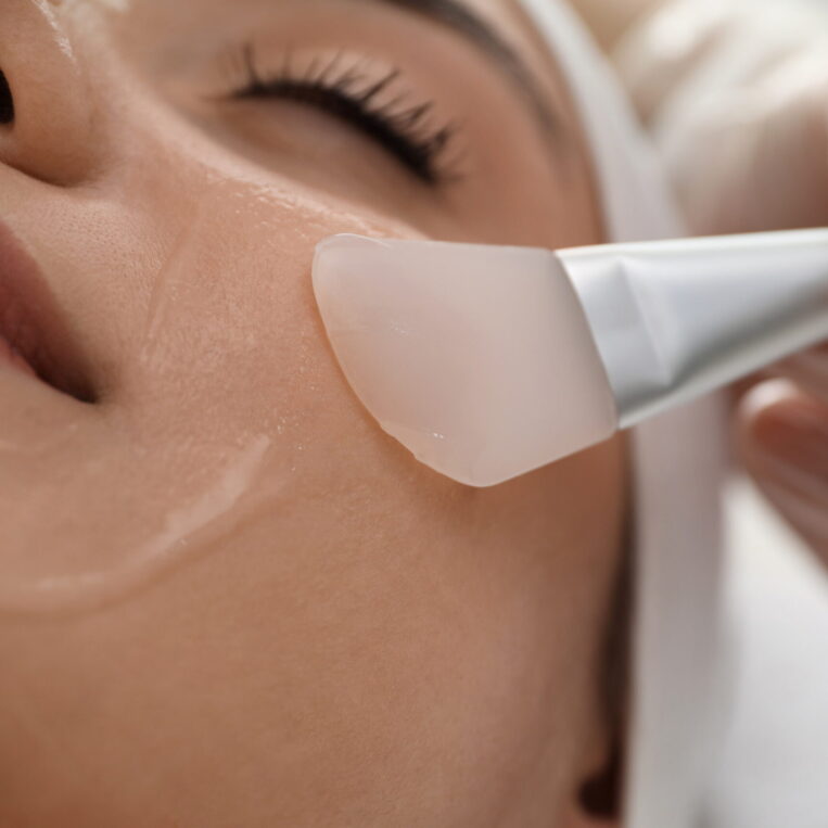 Chemical peel being applied to skin