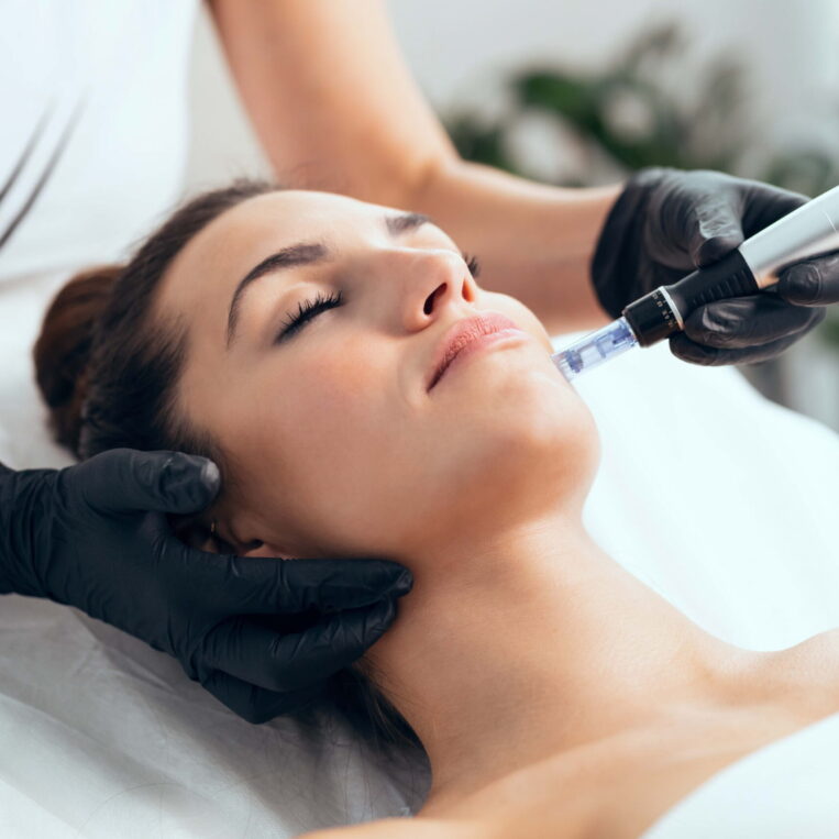 Microneedling treatments in Lewis Center